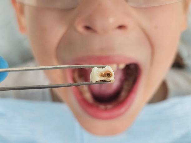Best Weekend Emergency Dentist in Parksdale, CA