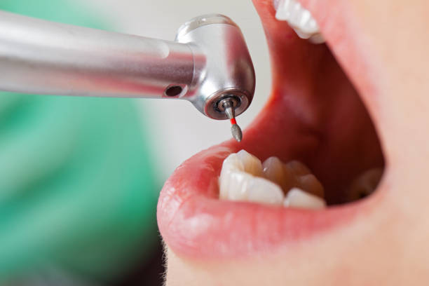 Best Emergency Treatment for Dental Infections or Abscesses in Parksdale, CA